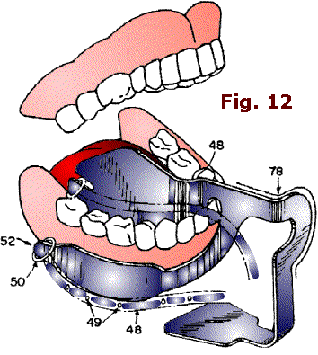 Fig. 12