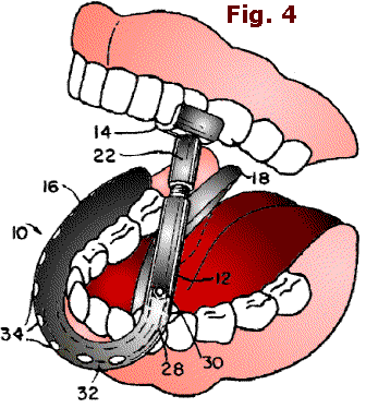 Fig. 4