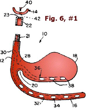 Fig. 6, #1