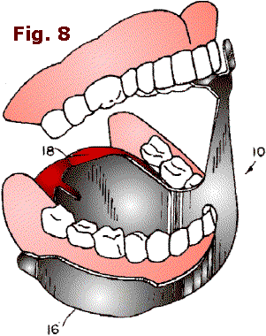 Fig. 8