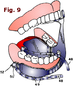 Fig. 9